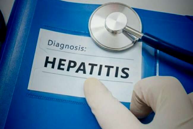 4 Anak Meninggal Dunia Diduga Karena Hepatitis Akut