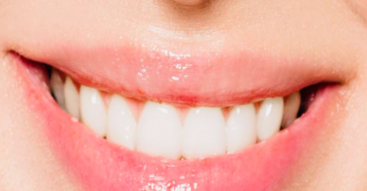 Cara Memutihkan Gigi Secara Alami, Supaya Tidak Minder dan Tak Percaya Diri