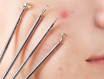Cara menggunakan acne clip dengan benar