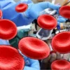Thalasemia memerlukan transfusi darah untuk memenuhi kekurangan sel darah merah