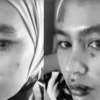 Kartika Putri Mengalami Masalah Kulit Serius, Wajah Melepuh, Netizen Ingatkan Untuk Menjaga Ucapan